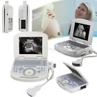 190891393838 Carejoy Usa Digital Medical Ultrasound Scanner Machine Convex