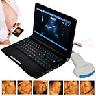 190891409850 Carejoy Laptop Ultrasound Scanner Diagnostic Convex Probe In