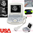 190891412164 Carejoy Us Portable Machine Ultrasound Scanner Convex Probe