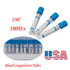 670041 Carejoy Buffered Sodium Citrate Blood Collection Tube Coagulation Use Ce
