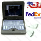 3.5convex Cms600p2 7.5linear Contec Ce Digital Portable Ultrasound Scanner Ultrasonic Machine Probes