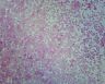 Ps0356 Gsc Escherichia Coli Smear 762047813103