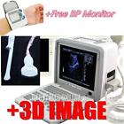 Rus-9000b New Carejoy Digital Portable Ultrasound Scanner Machine Convex 190891822574
