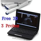 Rus-9000f Carejoy Digital Ultrasonic Ultrasound Scanner Convex Vignal Linear 190891823137