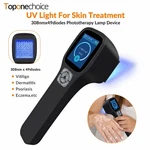 Handheld 308NM Uvb Light Therapy Machine Adjustable Dose & Time Mode Home Use. Fixed Price $1099.89.