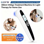 Portable 308NM Uvb Light Therapy Device For Targeted Skin Disorder Treatment. Fixed Price $470.59.