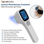 308NM Handheld Narrowband Uvb Lamp Light Phototherapy For Skin Treatment. Fixed Price $1099.69.