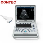 Ultrasonic Diagnostic System Abdomen/convex Probe Contec CMS600P2 Plus+free Pw. Fixed Price $2849.00.