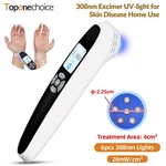 308NM Uv Light Therapy Ultraviolet Lamp For Hands Face Arm Feet Skin Disorder. Fixed Price $341.92.